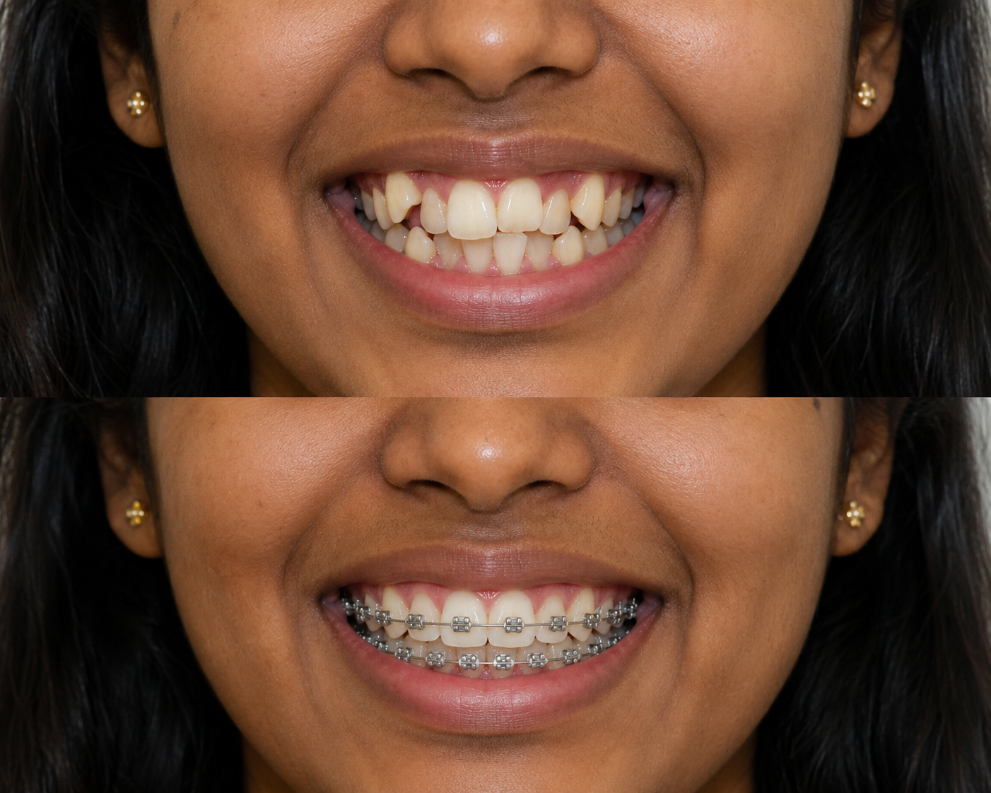 Priyanka Tile Before and After Treatment